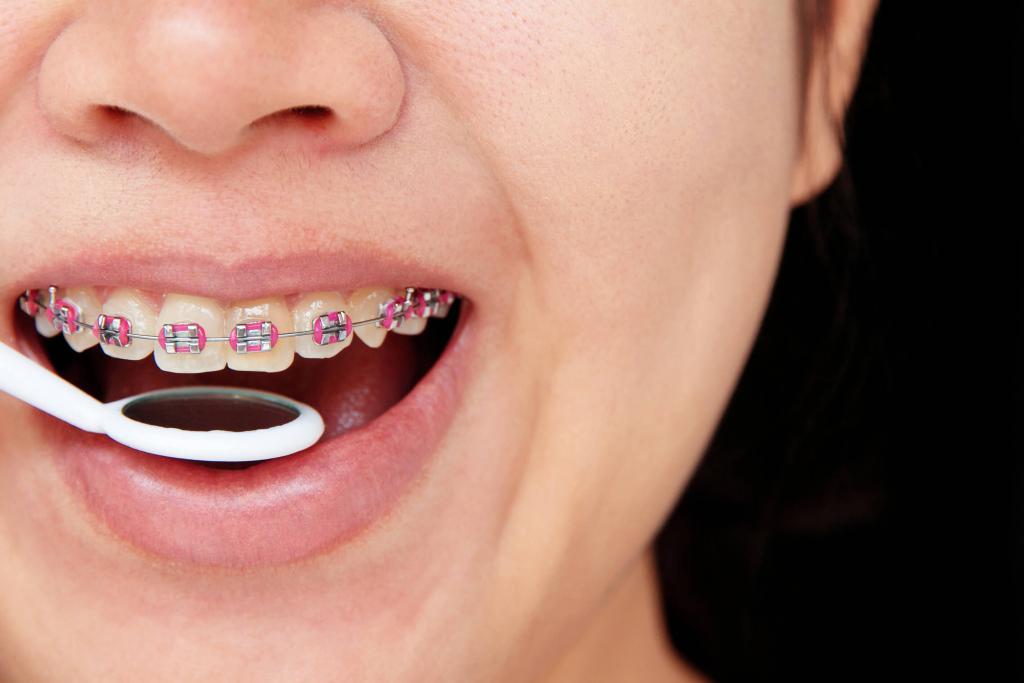 Orthodontic Treatment Meaning In Hindi