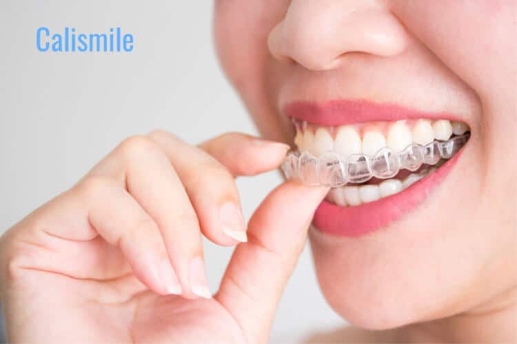 How Invisalign Improve Jawline