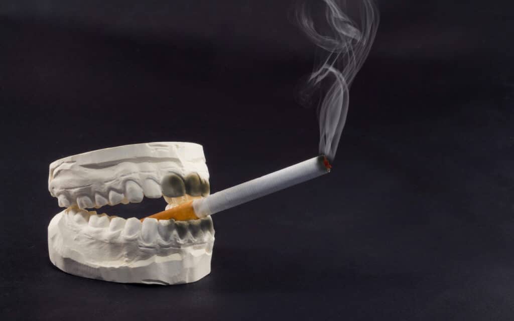 Smoking While Wearing Braces? - CaliSmile Orthodontics