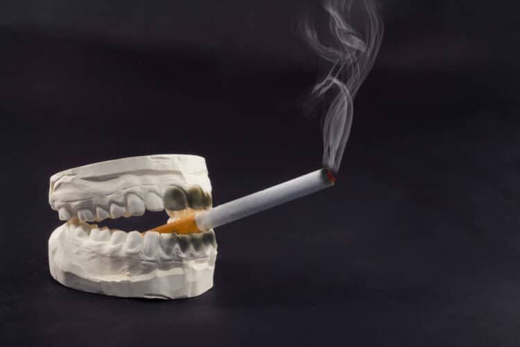 Smoking While Wearing Braces? - CaliSmile Orthodontics