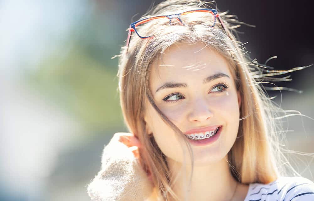 Investing in Dental Braces for a Perfect Smile | CaliSmile