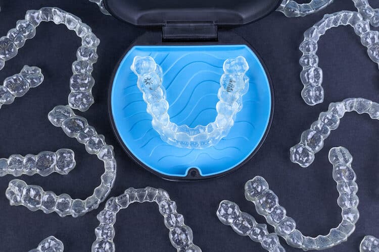 The Power Of Personalization: How Clear Aligners Can Be Customized For Each Patient | CaliSmile Orthodontics