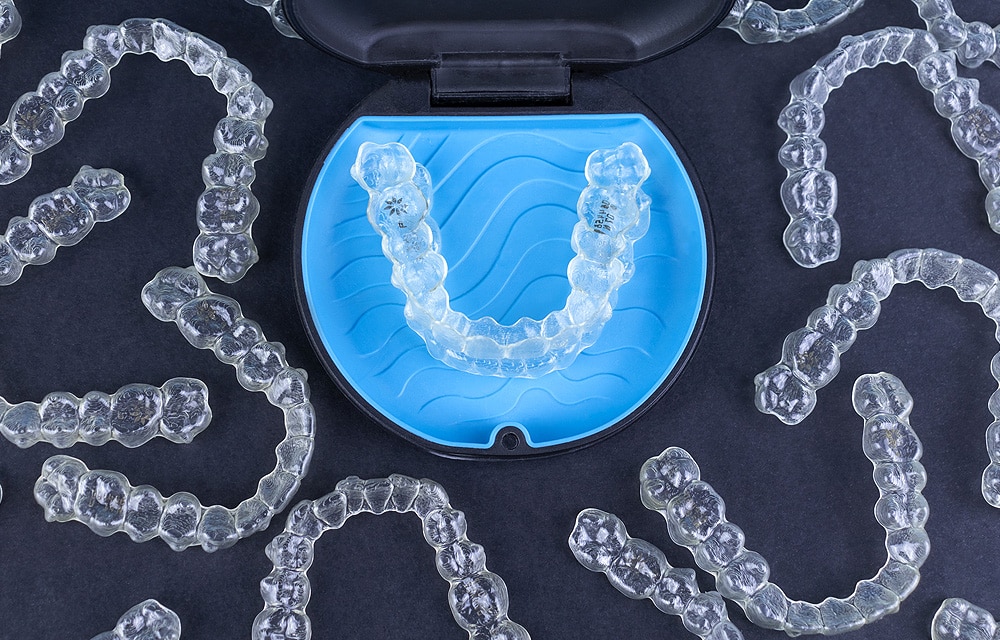 The Power Of Personalization: How Clear Aligners Can Be Customized For Each Patient | CaliSmile Orthodontics