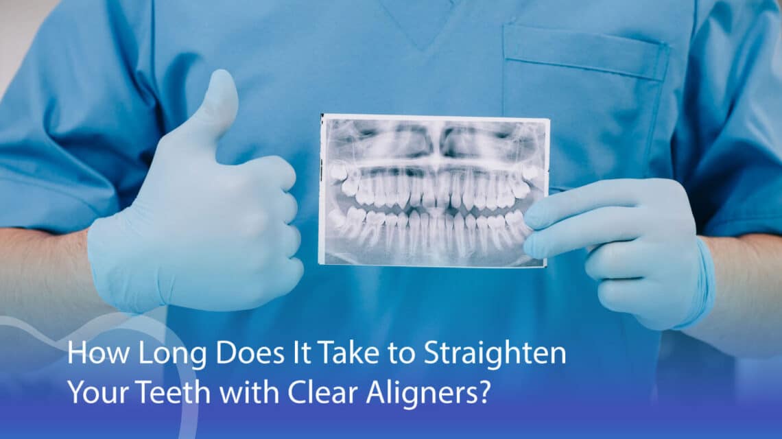 How Long To Straighten Teeth With Clear Aligners? - CaliSmile Orthodontics