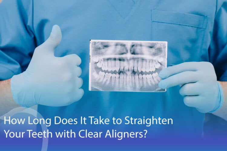 How Long To Straighten Teeth With Clear Aligners? - CaliSmile Orthodontics