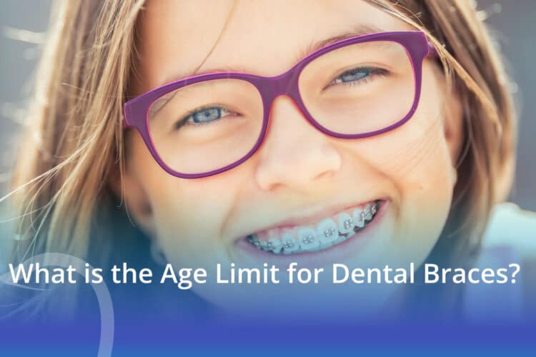 What is the Age Limit for Dental Braces? - CaliSmile Orthodontics