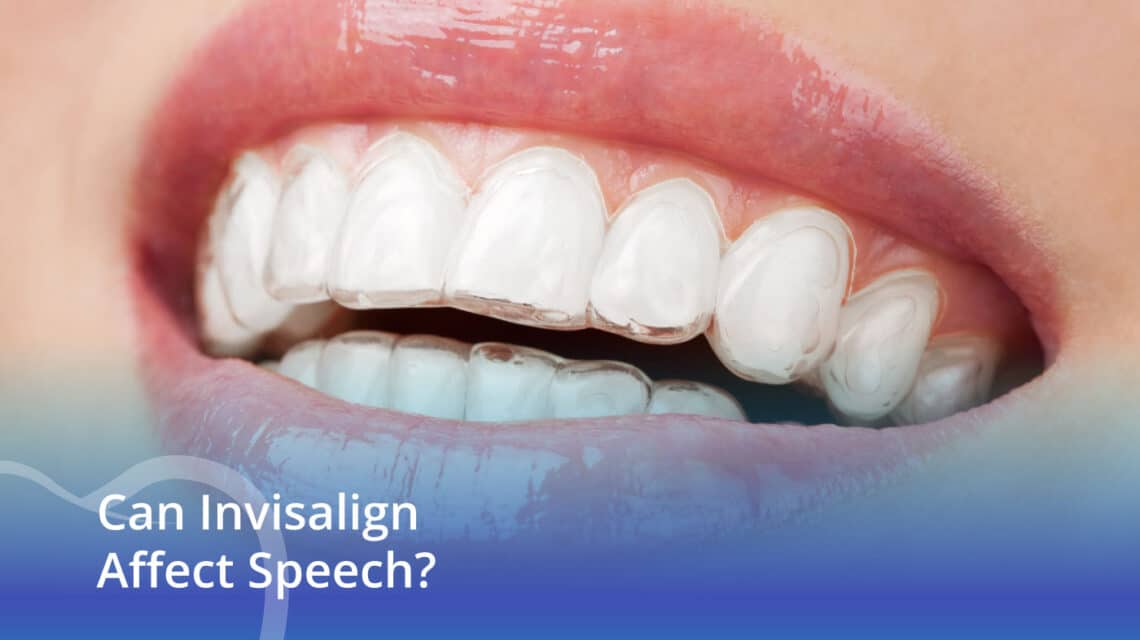 Can Invisalign Affect Speech? - CaliSmile Orthodontics