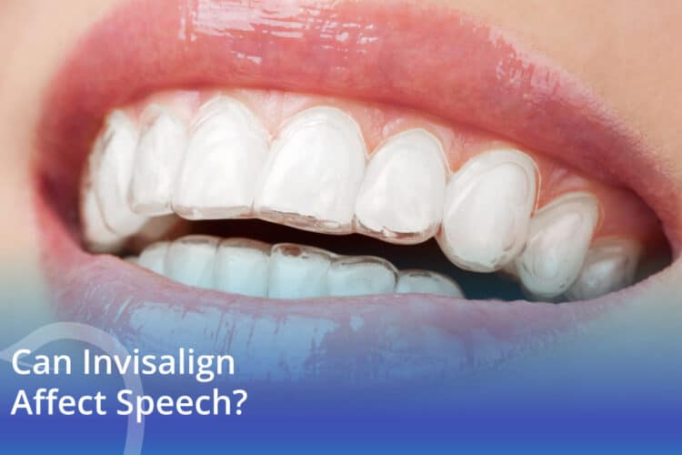 Can Invisalign Affect Speech? - CaliSmile Orthodontics