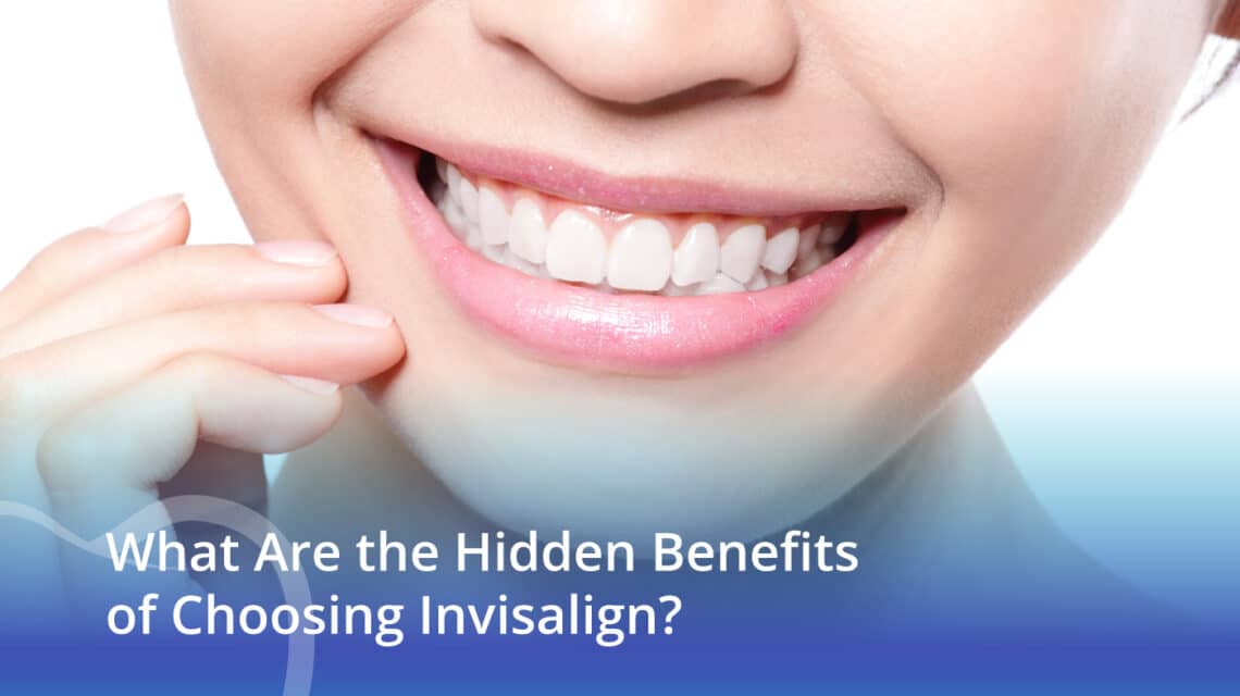 What Are the Hidden Benefits of Choosing Invisalign? - CaliSmile Orthodontics