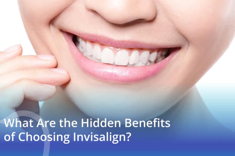 What Are the Hidden Benefits of Choosing Invisalign? - CaliSmile Orthodontics