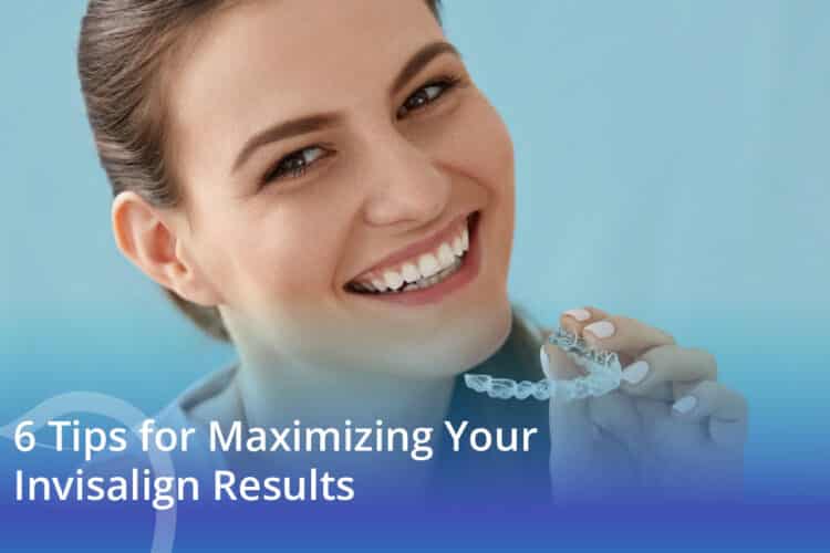 6 Tips for Maximizing Your Invisalign Results - CaliSmile Orthodontics